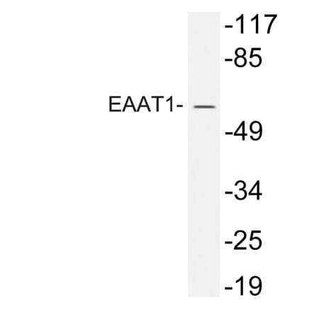 Western Blot - Anti-EAAT1 Antibody (R12-2120) - Antibodies.com