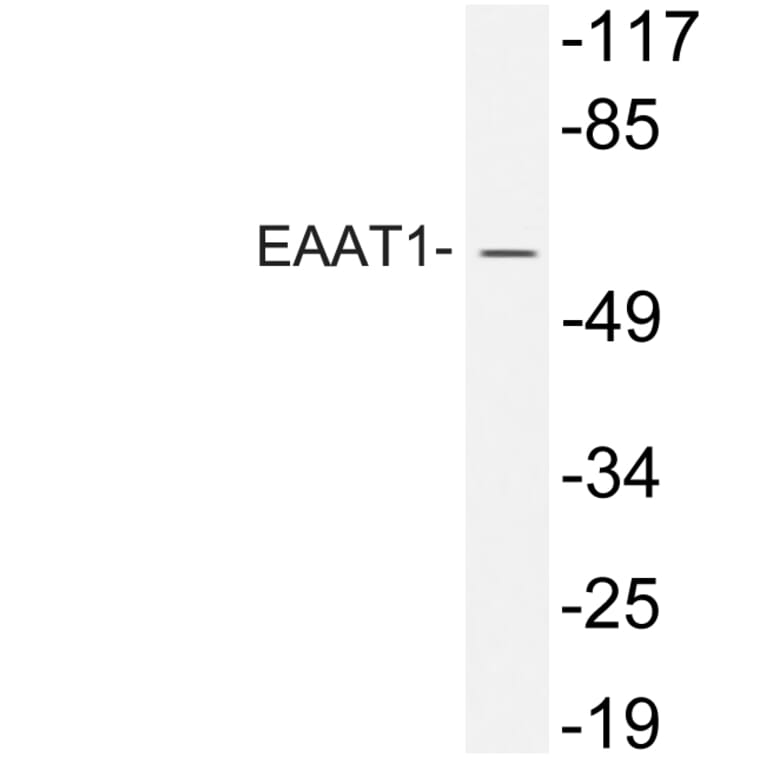 Western Blot - Anti-EAAT1 Antibody (R12-2120) - Antibodies.com