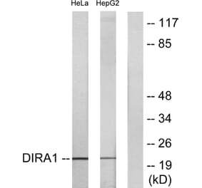 Western Blot - Anti-DIRA1 Antibody (C16016) - Antibodies.com