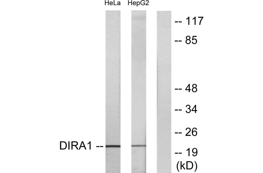 Western Blot - Anti-DIRA1 Antibody (C16016) - Antibodies.com