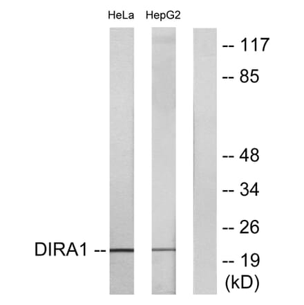 Western Blot - Anti-DIRA1 Antibody (C16016) - Antibodies.com