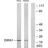 Western Blot - Anti-DIRA1 Antibody (C16016) - Antibodies.com