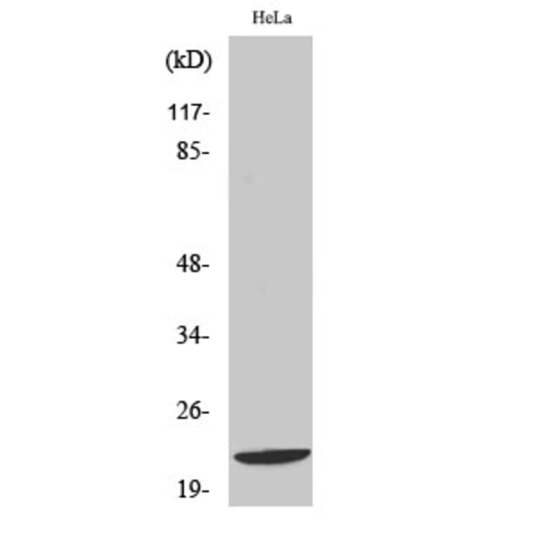 Western Blot - Anti-DIRA1 Antibody (C16016) - Antibodies.com