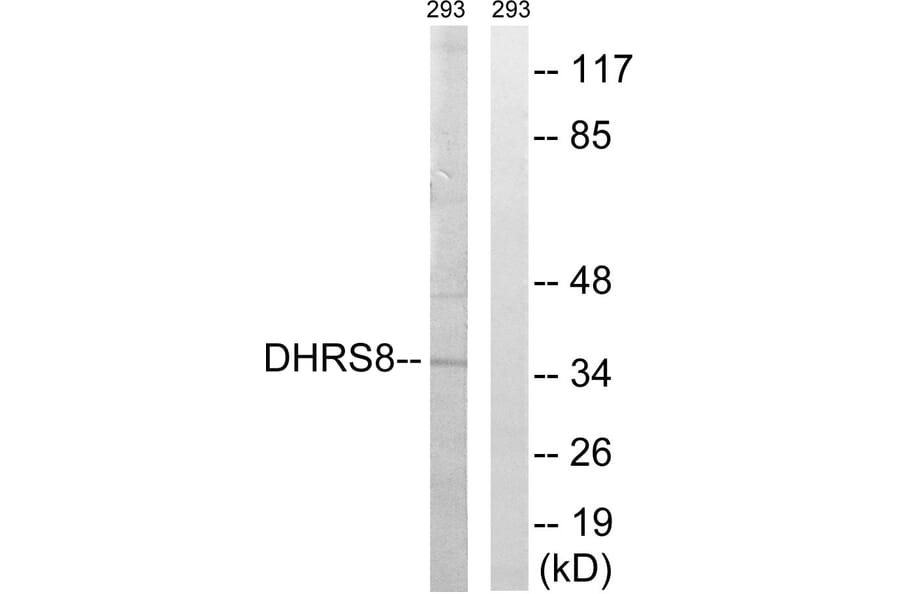Western Blot - Anti-DHRS8 Antibody (C15325) - Antibodies.com