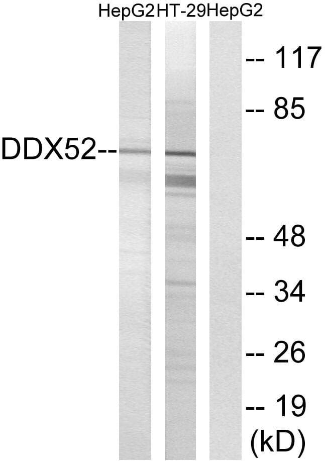 Western blot analysis of lysates from HepG2 and HT-29 cells using Anti-DDX52 Antibody. The right hand lane represents a negative control, where the antibody is blocked by the immunising peptide.