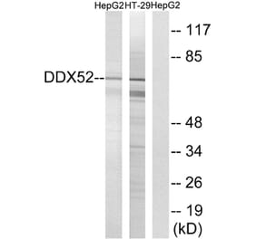 Western Blot - Anti-DDX52 Antibody (C17865) - Antibodies.com