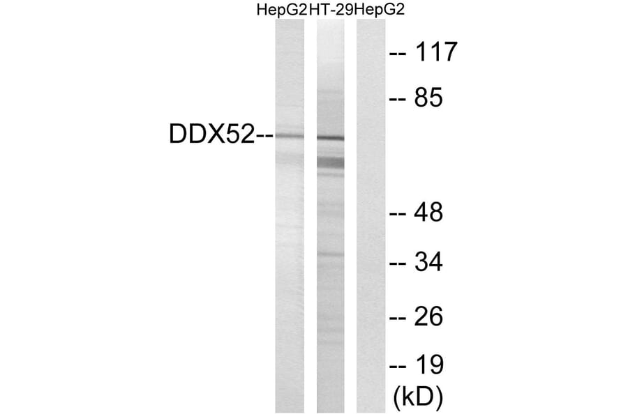 Western Blot - Anti-DDX52 Antibody (C17865) - Antibodies.com