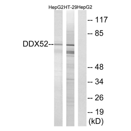 Western Blot - Anti-DDX52 Antibody (C17865) - Antibodies.com