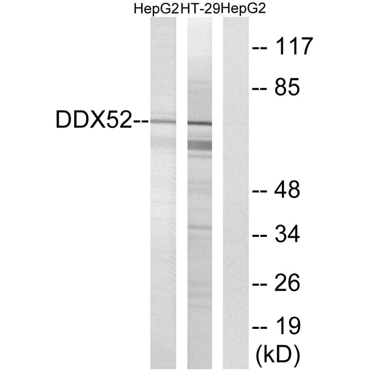 Western Blot - Anti-DDX52 Antibody (C17865) - Antibodies.com