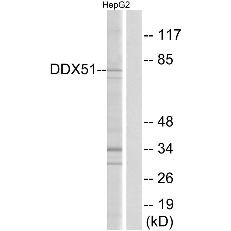 Western Blot - Anti-DDX51 Antibody (C14656) - Antibodies.com