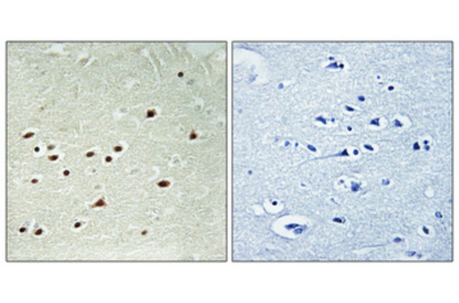 Immunohistochemistry - Anti-DDX51 Antibody (C14656) - Antibodies.com
