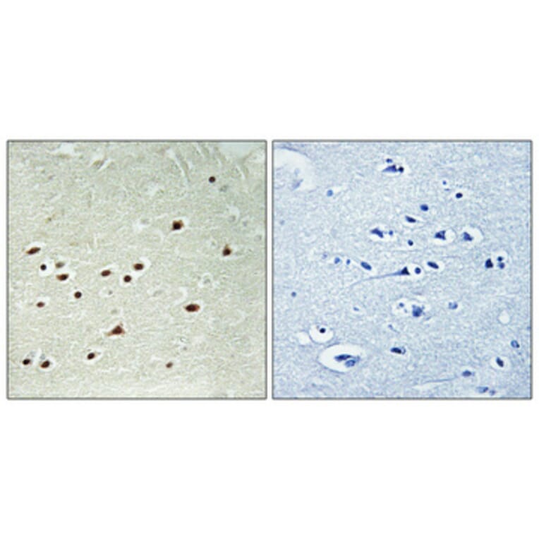 Immunohistochemistry - Anti-DDX51 Antibody (C14656) - Antibodies.com