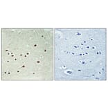 Immunohistochemistry - Anti-DDX51 Antibody (C14656) - Antibodies.com
