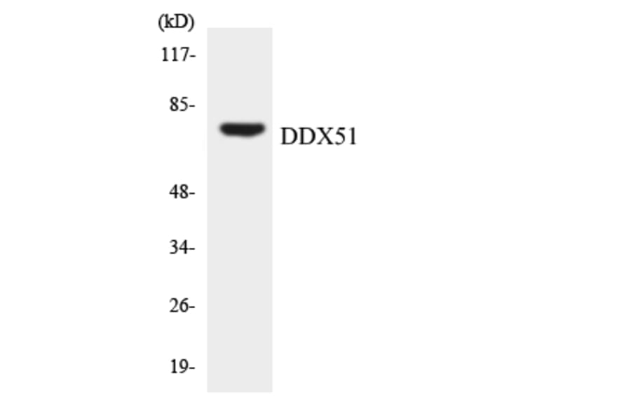 Western Blot - Anti-DDX51 Antibody (R12-2692) - Antibodies.com