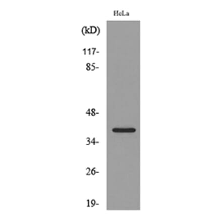 Western Blot - Anti-CXCR6 Antibody (C30466) - Antibodies.com