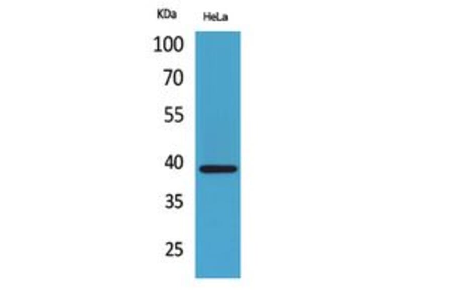Western Blot - Anti-CXCR6 Antibody (C30466) - Antibodies.com