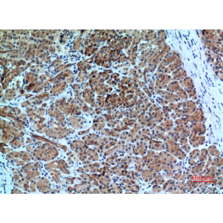 Immunohistochemistry - Anti-CXCR6 Antibody (C30466) - Antibodies.com