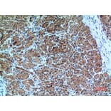 Immunohistochemistry - Anti-CXCR6 Antibody (C30466) - Antibodies.com