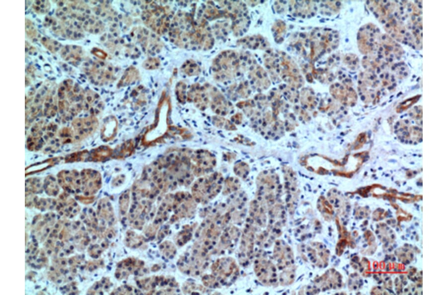 Immunohistochemistry - Anti-CXCR6 Antibody (C30466) - Antibodies.com