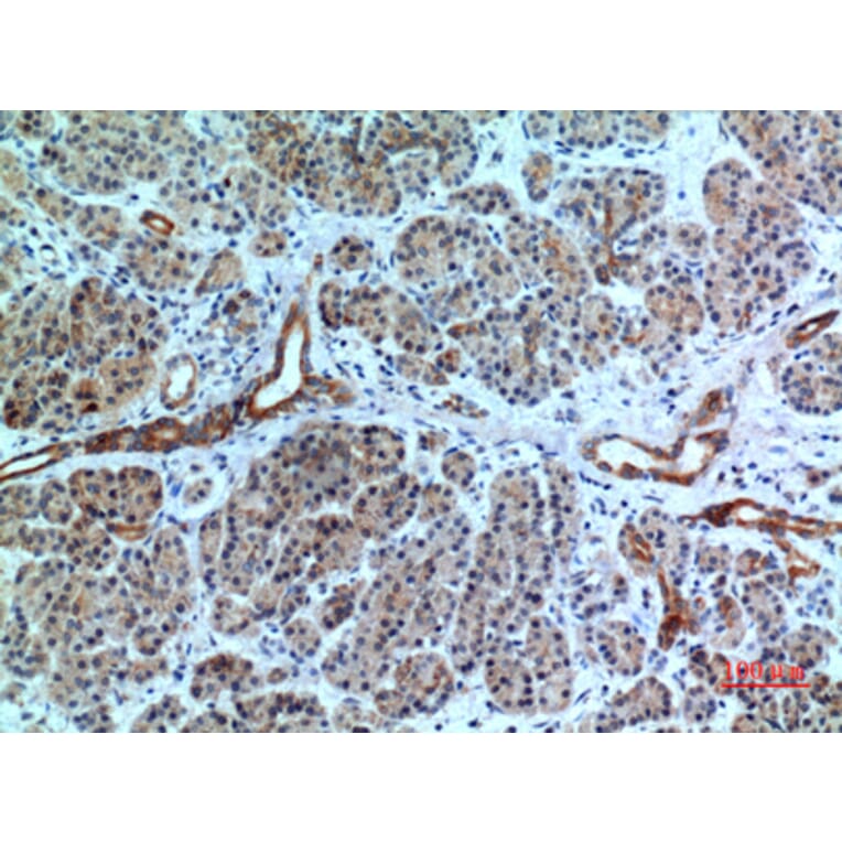 Immunohistochemistry - Anti-CXCR6 Antibody (C30466) - Antibodies.com