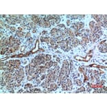 Immunohistochemistry - Anti-CXCR6 Antibody (C30466) - Antibodies.com