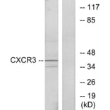 Western Blot - Anti-CXCR3 Antibody (G063) - Antibodies.com
