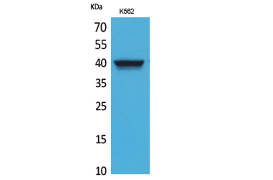 Western Blot - Anti-CXCR3 Antibody (C30514) - Antibodies.com