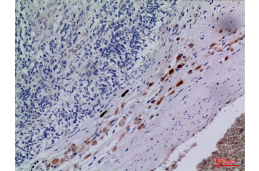 Immunohistochemistry - Anti-CXCR3 Antibody (C30514) - Antibodies.com