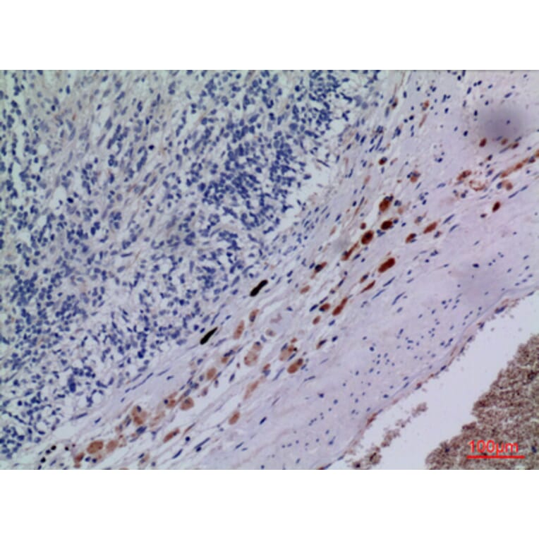 Immunohistochemistry - Anti-CXCR3 Antibody (C30514) - Antibodies.com