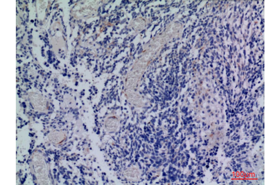 Immunohistochemistry - Anti-CXCR3 Antibody (C30514) - Antibodies.com