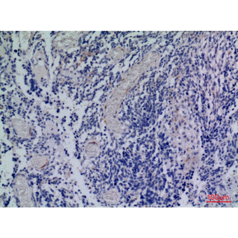 Immunohistochemistry - Anti-CXCR3 Antibody (C30514) - Antibodies.com