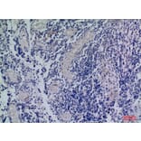 Immunohistochemistry - Anti-CXCR3 Antibody (C30514) - Antibodies.com