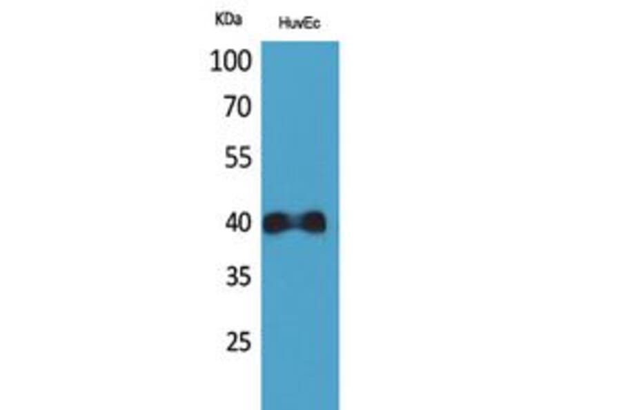 Western Blot - Anti-CXCR2 Antibody (C30448) - Antibodies.com