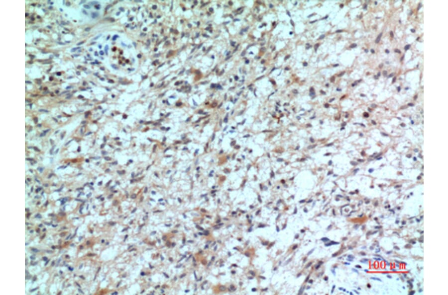 Immunohistochemistry - Anti-CXCR2 Antibody (C30448) - Antibodies.com