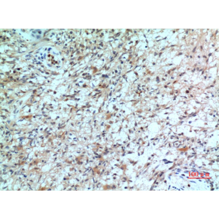 Immunohistochemistry - Anti-CXCR2 Antibody (C30448) - Antibodies.com