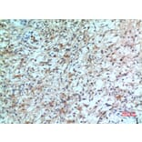 Immunohistochemistry - Anti-CXCR2 Antibody (C30448) - Antibodies.com