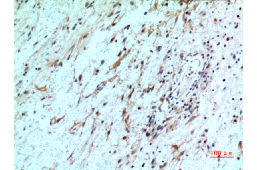 Immunohistochemistry - Anti-CXCR2 Antibody (C30448) - Antibodies.com