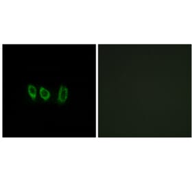 Immunofluorescence - Anti-CSTL1 Antibody (C15279) - Antibodies.com