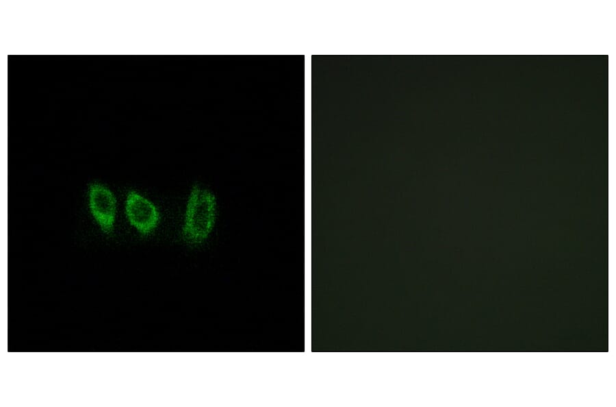 Immunofluorescence - Anti-CSTL1 Antibody (C15279) - Antibodies.com