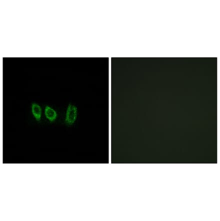 Immunofluorescence - Anti-CSTL1 Antibody (C15279) - Antibodies.com