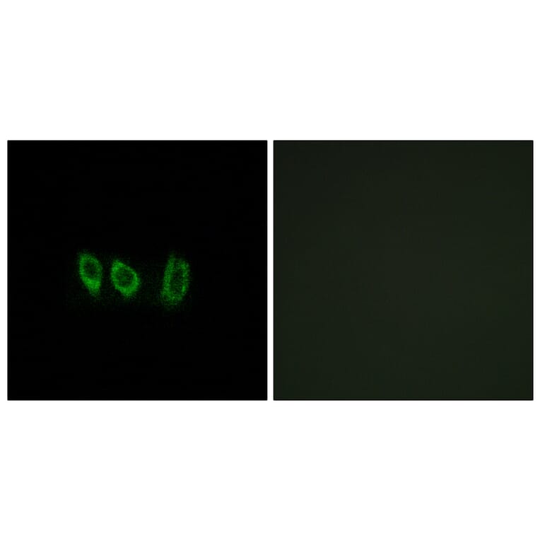 Immunofluorescence - Anti-CSTL1 Antibody (C15279) - Antibodies.com