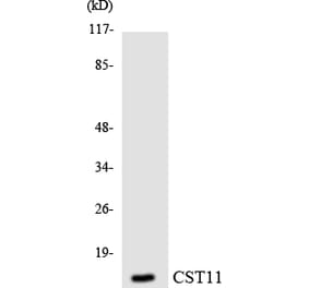 Western Blot - Anti-CST11 Antibody (R12-2657) - Antibodies.com