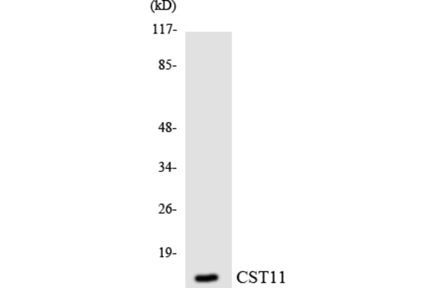 Western Blot - Anti-CST11 Antibody (R12-2657) - Antibodies.com