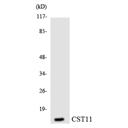 Western Blot - Anti-CST11 Antibody (R12-2657) - Antibodies.com
