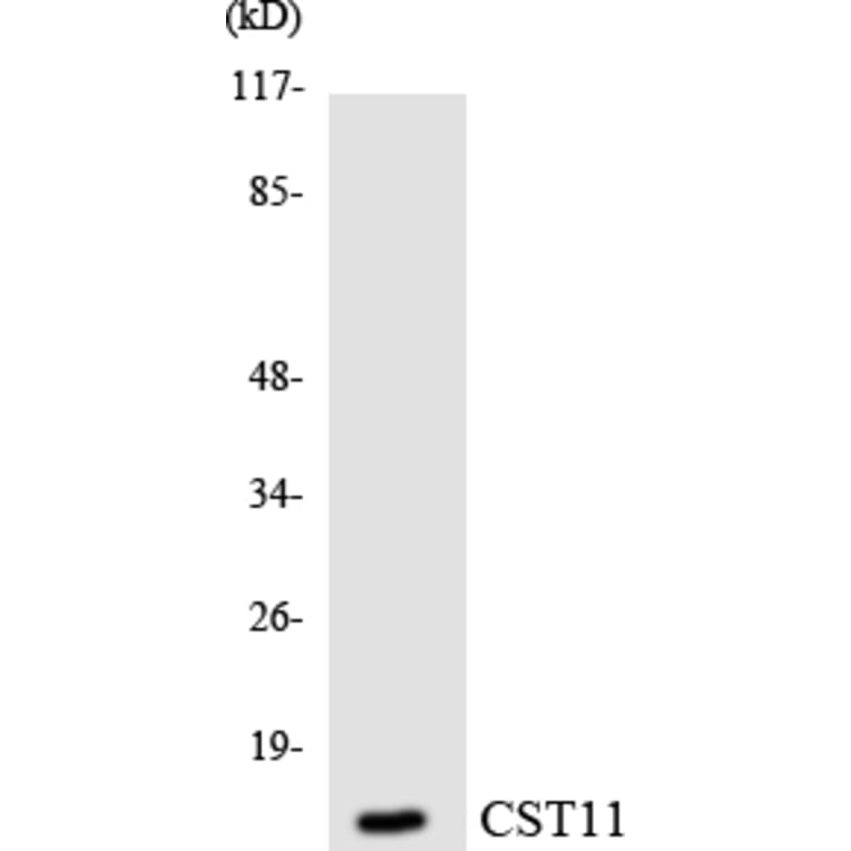 Western Blot - Anti-CST11 Antibody (R12-2657) - Antibodies.com