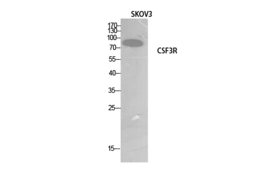 Western Blot - Anti-CSF3R Antibody (C30418) - Antibodies.com