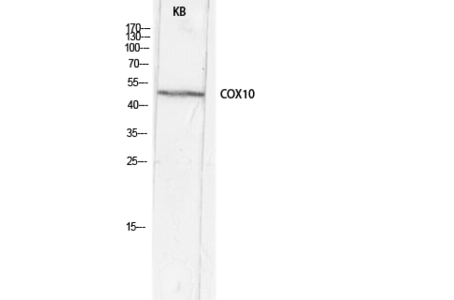 Western Blot - Anti-COX10 Antibody (R12-2102) - Antibodies.com