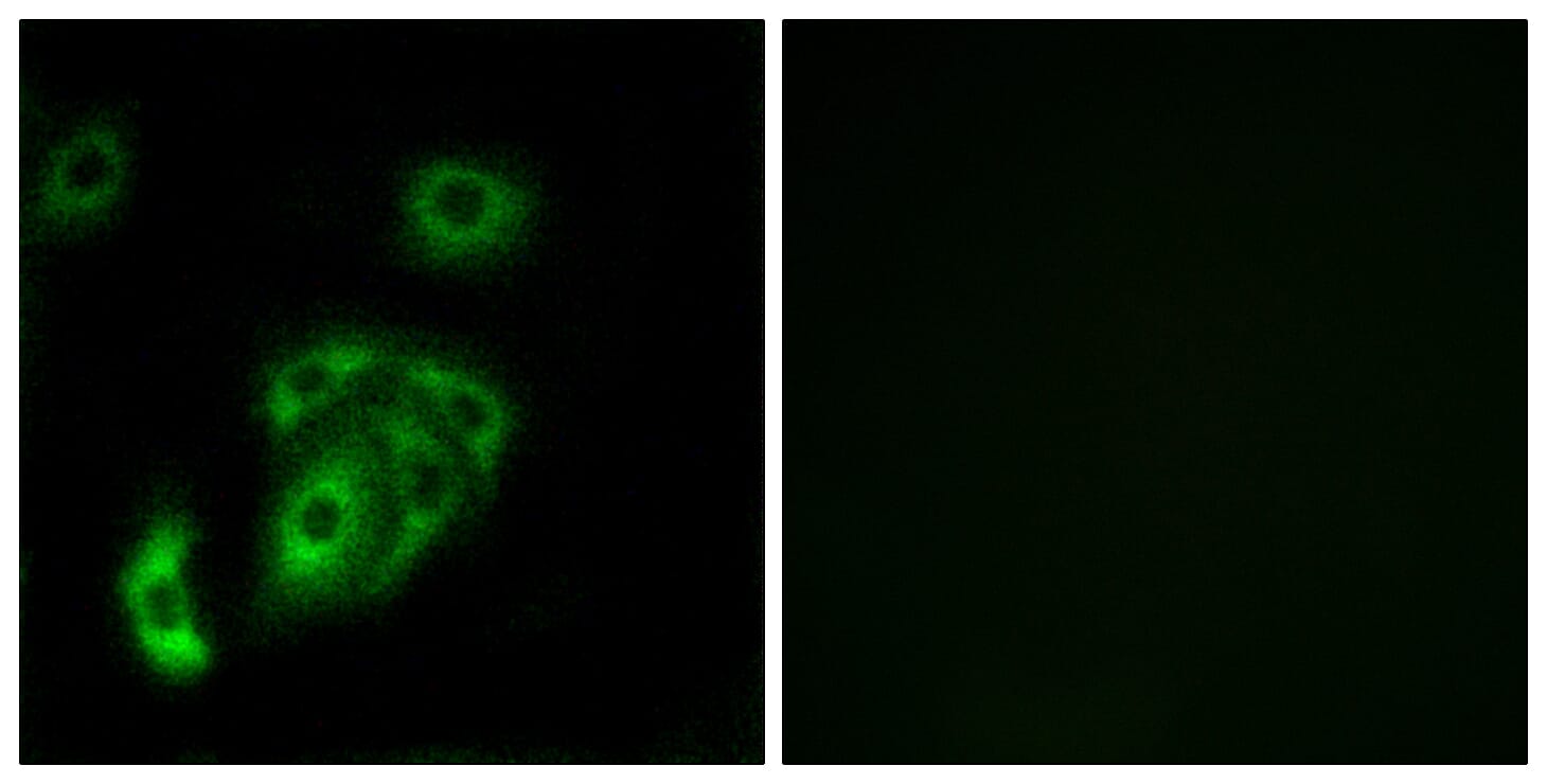 Immunofluorescence analysis of A549 cells using Anti-CNTN5 Antibody. The right hand panel represents a negative control, where the antibody was pre-incubated with the immunising peptide.