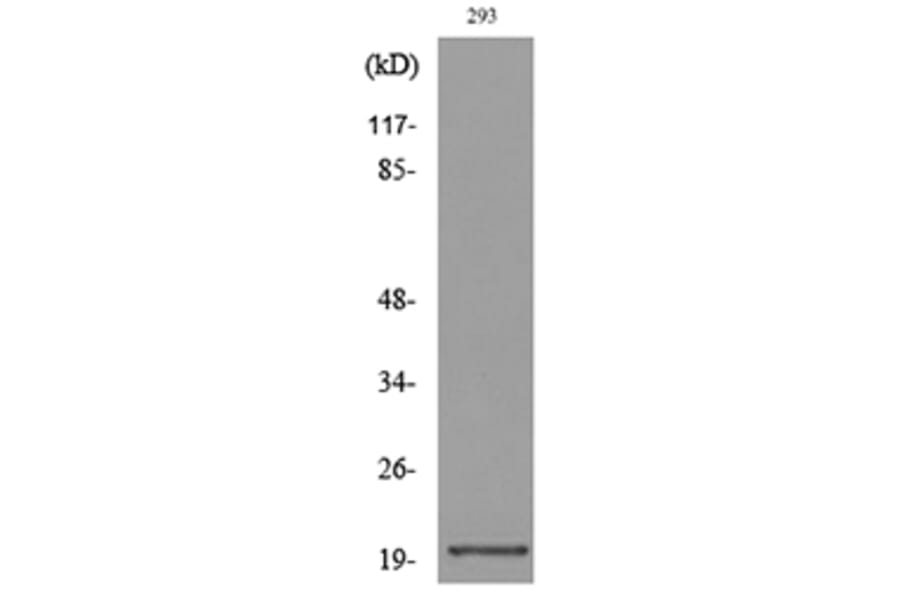 Western Blot - Anti-CMTM6 Antibody (C30731) - Antibodies.com