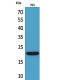 Western Blot - Anti-CMTM6 Antibody (C30731) - Antibodies.com